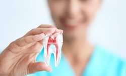 Common Misconceptions About Tooth Extractions and Their Implications