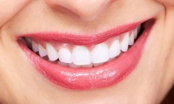 About Orthodontix Dental Clinic in Dubai UAE Teeth Cleaning
