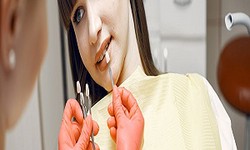 Top 5 Reasons to Opt for Wisdom Teeth Removal