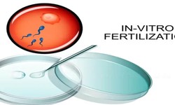 Exploring the Benefits and Risks of IVF Treatment: A Comprehensive Guide