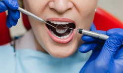 Root Canal Therapy and Your Overall Health: How Infected Teeth Can Impact Your Well-Being