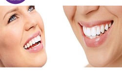 What is the importance of teeth whitening for oral health?