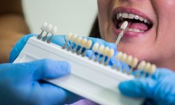 Cosmetic Dentistry: A Guide to Enhance Your Smile