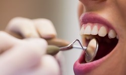 Healthy Habits That Make People Have Strong Gums