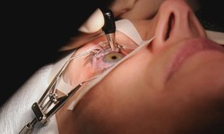 Lasik Eye Surgery & its Benefits