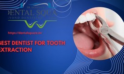Best Dentist For Tooth Extraction