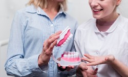 A Comprehensive Guide to Dentures in Knowle: Types, Costs, and Maintenance