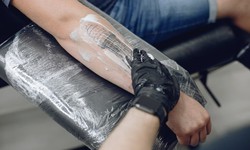 The Latest Trends and Technologies in Tattoo Removal in Dallas TX