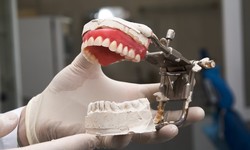 Why Choose Dental Lab Jacksonville, FL for Your Dental Needs