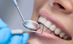 Discover the Best Dentist in Guelph for Safe and Effective Dental Bridges