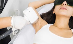 How Does Laser Hair Removal Work?