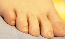 The Surprising Reasons for Yellow Feet and How to Fix Them!