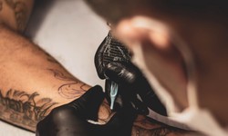 Navigating Tattoo Removal Costs in NYC: Tips and Insights