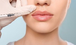 The Ultimate Guide to Dermal Fillers in Dubai: What You Need to Know