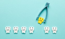 Wisdom Teeth Removal: Is It Worth the Cost?