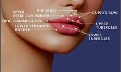 Why There Is A Need For IPL Photofacial And Lip Line Treatment?