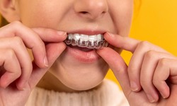 How to determine if you need braces or not