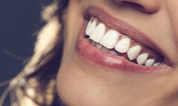 Unveiling the Mystery: Exploring Dark Gums and Their Causes