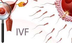 Exploring Advanced Techniques: How an IVF Doctor Enhances Success Rates