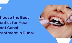 How to Choose the Best Dentist for Your Root Canal Treatment in Dubai