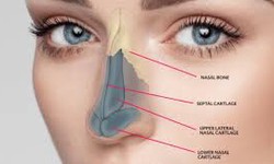 Rhinoplasty Surgery: For Anyone Considering Nose Job