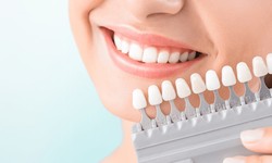Teeth Whitening and Oral Health: Understanding the Relationship between Whitening and Dental Wellness