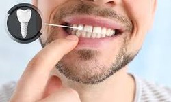 A Beautiful Smile Can Be Achieved Through Cosmetic Dentistry
