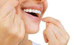 Getting the Most out of Veneers: Transforming your Smile.