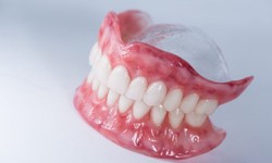 Affordable Dentures: Providing Natural-Looking Teeth