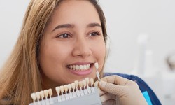 Transform Your Smile with Porcelain Veneers in Brisbane