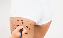 We offer the Best Plastic Surgeon in Turkey with the Best Services