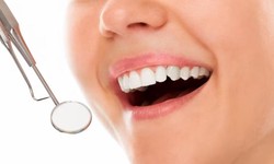 The Benefits of Teeth Whitening: Brightening Smiles in Tuscaloosa