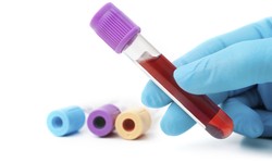 Blood Tests at Home: Convenience and Accessibility for Improved Healthcare