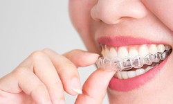 Introduction to Invisible Teeth Aligners: A Modern Orthodontic Solution