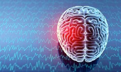 Traumatic Brain Injury (TBI) Following Car Accidents? What You Need To Know