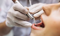 Urgent Care for Your Smile: VA Emergency Dentist to the Rescue