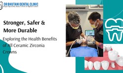 Stronger, Safer, and More Durable: Exploring the Health Benefits of All Ceramic Zirconia Crowns