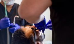 How Can An Emergency Dentist In West Houston Provide Immediate Care For Dental Emergencies?