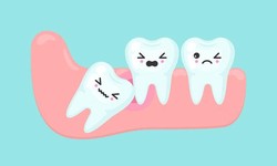 Wisdom Tooth Pain: Symptoms, Causes, Remedies & Relief