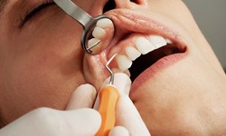 Exploring the Advantages of Cosmetic Dentistry Services