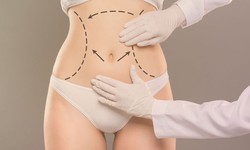 There are many benefits to having a tummy tuck