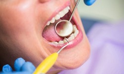 How to Prevent Recurring Bleeding Gums: Tips and Strategies