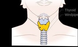 Understanding Thyroid Health: Early Warning Signs of Thyroid Problems