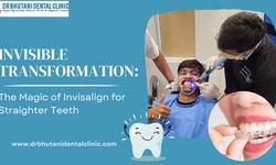 Invisible Transformation: The Magic of Invisalign for Straighter Teeth