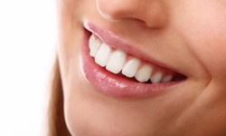 Unveiling Your Best Smile: The Transformative Power of Cosmetic Dentistry in Huntington Beach