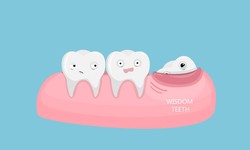 Best Dentist in Houston: Who's Your Go-To for Oral Health?