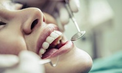 Unveiling Excellence: Your Guide to Choosing a Canyon Dentist