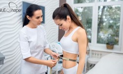Popular Body Slimming Methods in Singapore: Comparing Techniques