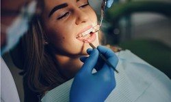 What You Need to Know About Dental Implants in Baton Rouge