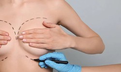 The Positive Effects of Plastic Surgery On People